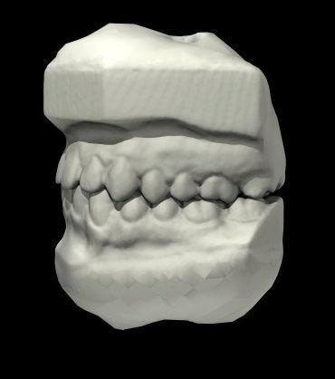 various_scans_teeth_1