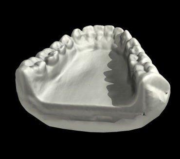 various_scans_teeth_2