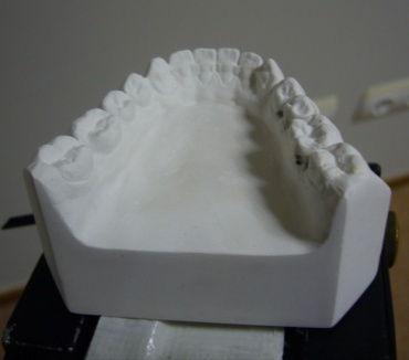 various_scans_teeth_2_orig