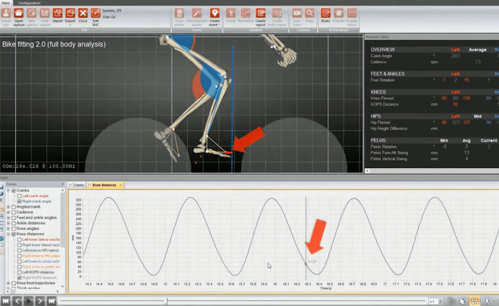STT Systems 3DMA bike fitting software interface displaying full body analysis, motion capture data, and knee distance graphs for KOPS measurement.
