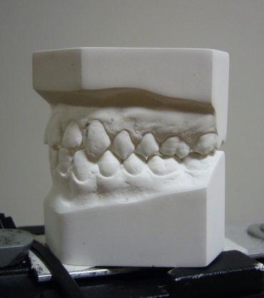 various_scans_teeth_1_orig.jpg
